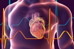 Rischio cardiovascolare