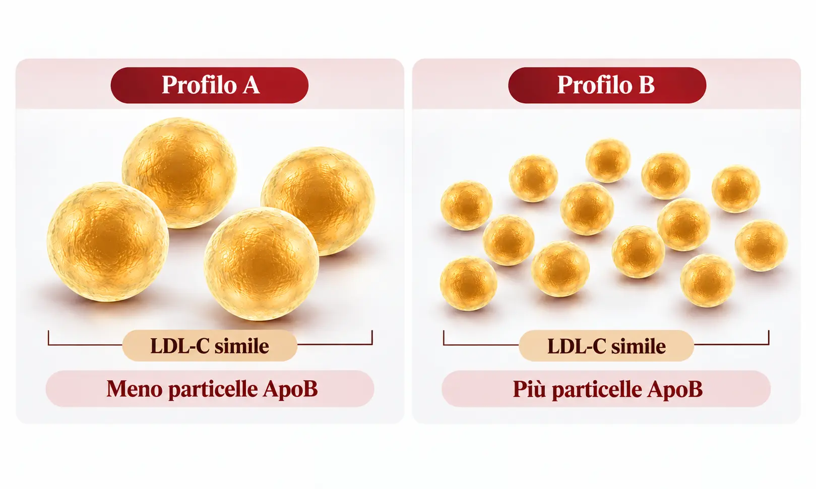Diagramma con due profili: poche particelle LDL grandi nel profilo A e numerose particelle più piccole nel profilo B, con LDL-C simile.